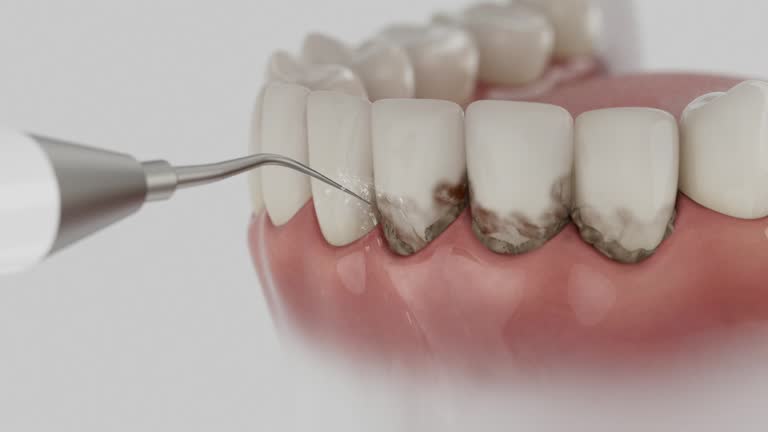 Trusted Dental Crowns And Bridges service in Conroe, TX - Dentist Open Now